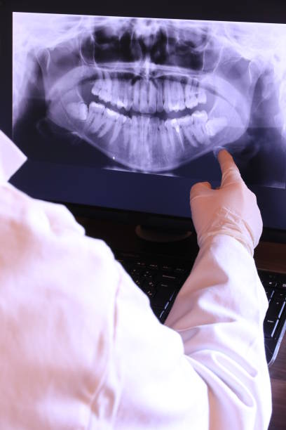 Best Emergency Root Canal Treatment in Benson, NC