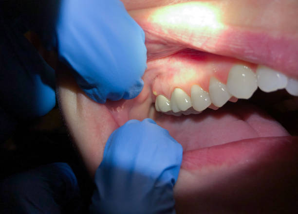Best 24-Hour Emergency Dentist in Benson, NC