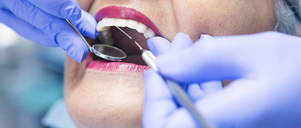Best Emergency Dental Care for Broken or Chipped Teeth in Benson, NC